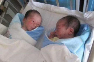 面对这对同卵双胞胎生产难题，“多亏上海专家来了”
