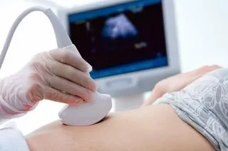 为什么孕早期会出血？妇产科医生分析，可能是这5种原因