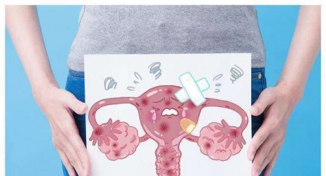 如何早期发现子宫肌瘤？