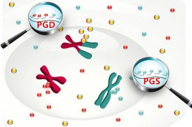 第三代试管婴儿PGD可以筛查出哪些遗传疾病？