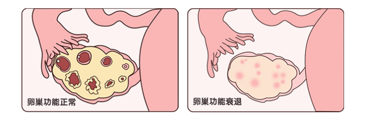 试管失败,两回胎停!四年未孕又查出甲状腺癌的她竟然怀孕了