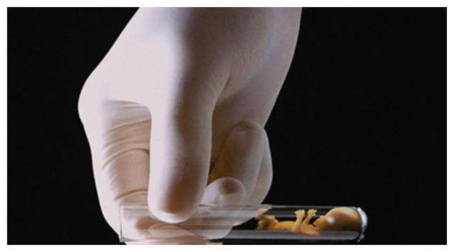 41岁童年女神做试管,自己在肚皮上打针,取卵13颗全没活,太可怜