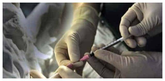 41岁童年女神做试管,自己在肚皮上打针,取卵13颗全没活,太可怜