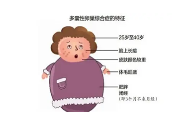多囊卵巢拖久了会严重吗?怎么治疗?
