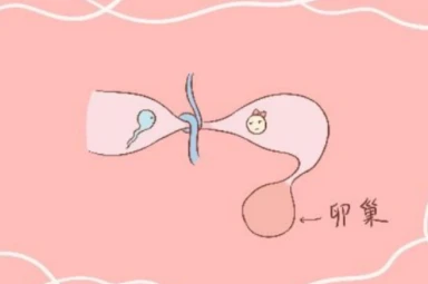 女性输卵管结扎了还能考虑试管婴儿辅助生育吗？