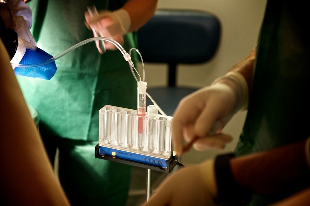 为什么70%的家庭会优先选第三代试管婴儿?