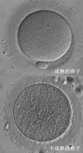 解读试管婴儿之捡卵:卵子是如何被挑选的? 解读试管婴儿之捡卵:卵子是如何被挑选的?