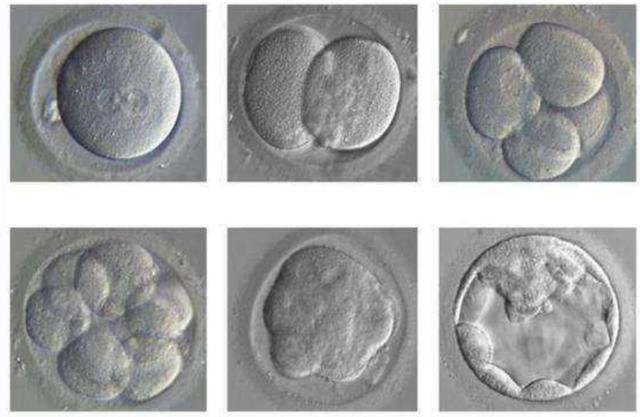 揭秘第三代试管婴儿，它真的安全吗？