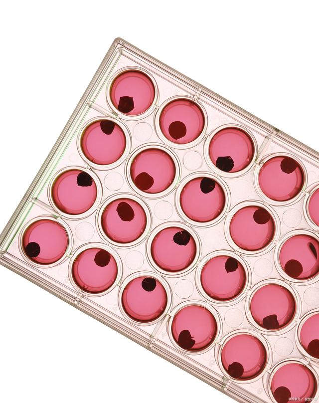 试管婴儿取卵复杂吗?取卵前需要注意些什么? 试管婴儿取卵复杂吗?取卵前需要注意些什么?