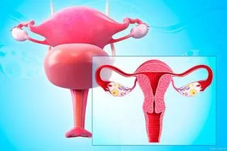 输卵管堵塞应选择哪种治疗方法？