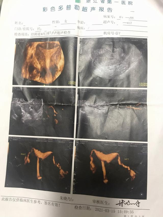 记录输卵管造影术的经过及检查结果