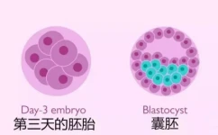 试管婴儿移植选胚胎还是囊胚？要看你自己的身体情况