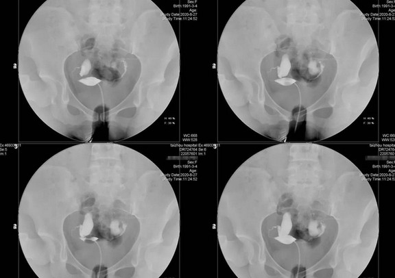 一直怀不上需要做哪些检查?什么时间查做合适? 一直怀不上需要做哪些检查?什么时间查做合适?