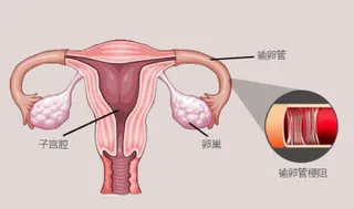 输卵管性不孕的检查方法有哪些？