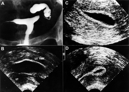 如何自我检查不孕,可以看完这些步骤! 如何自我检查不孕,可以看完这些步骤!