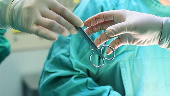 什么是“巧克力囊肿”?与多囊卵巢综合征究竟是不是一回事儿? 什么是“巧克力囊肿”?与多囊卵巢综合征究竟是不是一回事儿?