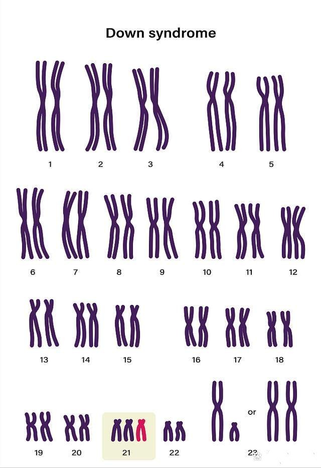 什么是染色体异常?染色体异常离我们并不遥远 什么是染色体异常?染色体异常离我们并不遥远