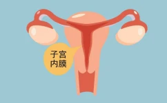 子宫内膜增生需要做哪些检查？