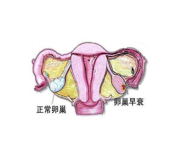 试管婴儿卵泡发育差的原因是什么？怎么调理？