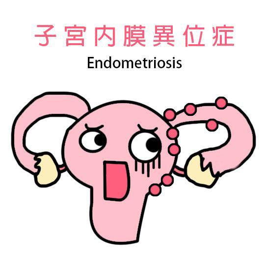 子宫内膜异位症可以做试管婴儿吗? 子宫内膜异位症可以做试管婴儿吗?