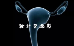 记录输卵管造影术的经过及检查结果