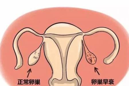 是否促排卵会提前将储存的卵子耗尽,导致卵巢早衰呢? 是否促排卵会提前将储存的卵子耗尽,导致卵巢早衰呢?