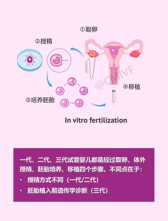 三代试管技术和一代二代有什么区别? 三代试管技术和一代二代有什么区别?