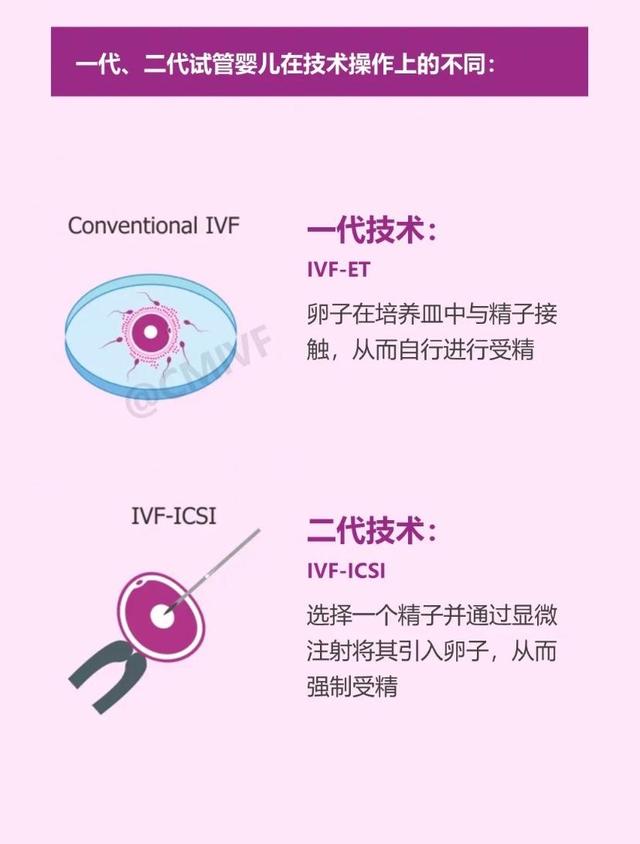 三代试管技术和一代二代有什么区别? 三代试管技术和一代二代有什么区别?