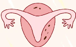 子宫内膜薄或厚到底该怎么调理？