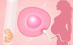 体外受精-胚胎移植技术适用于哪些人？