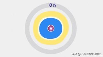 试管婴儿的步骤、预算和时间管理