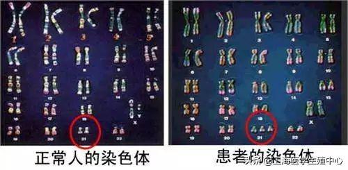 这6种人群做试管婴儿,赶紧做染色体检查! 这6种人群做试管婴儿,赶紧做染色体检查!