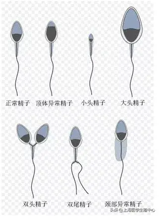 辅助生殖技术中精液是怎么优化的? 辅助生殖技术中精液是怎么优化的?