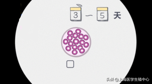 试管婴儿的步骤、预算和时间管理