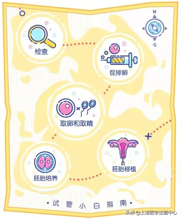 试管婴儿的步骤、预算和时间管理