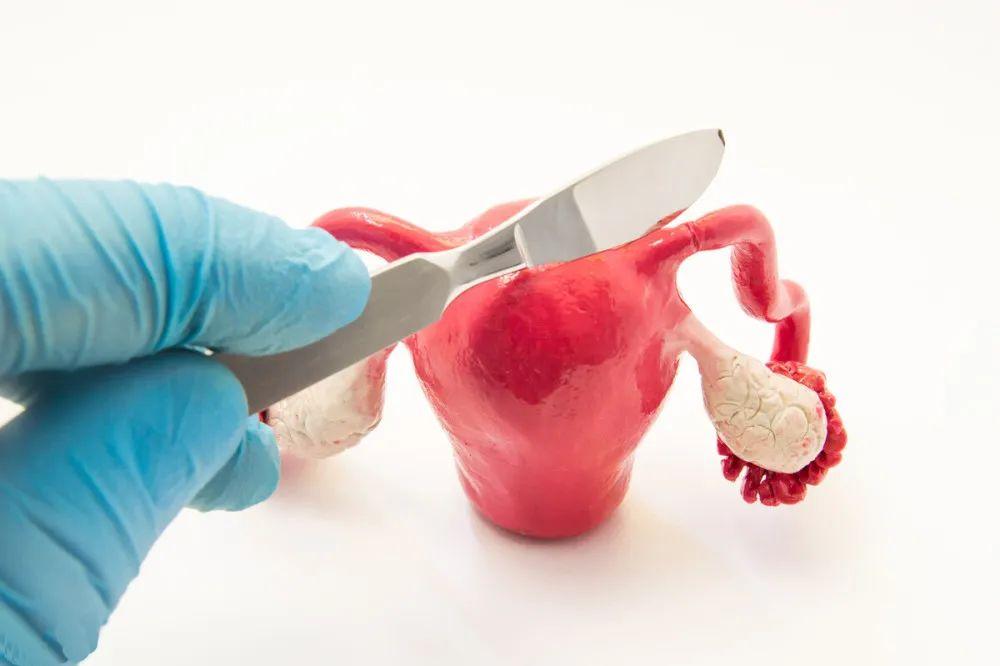 两侧输卵管都切除了还会怀孕吗 两侧输卵管都切除了还会怀孕吗