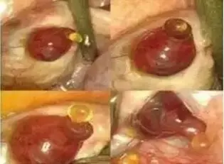 卵泡成熟后不破裂是怎么回事? 卵泡成熟后不破裂是怎么回事?