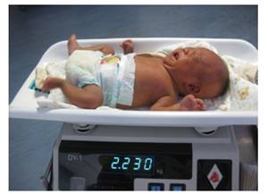 试管婴儿的产科风险是什么? 试管婴儿的产科风险是什么?