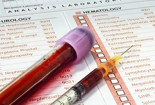 早孕期怎样监测血清HCG