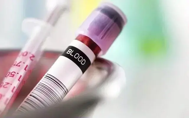 试管周期为什么要多次抽血? 试管周期为什么要多次抽血?