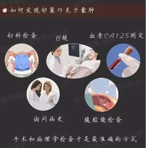 巧囊、息肉、肌瘤,备孕两年不得,试管一次成功 巧囊、息肉、肌瘤,备孕两年不得,试管一次成功
