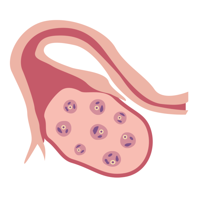 「试管小白」为提高成功率,打降调多取几个卵吧 「试管小白」为提高成功率,打降调多取几个卵吧