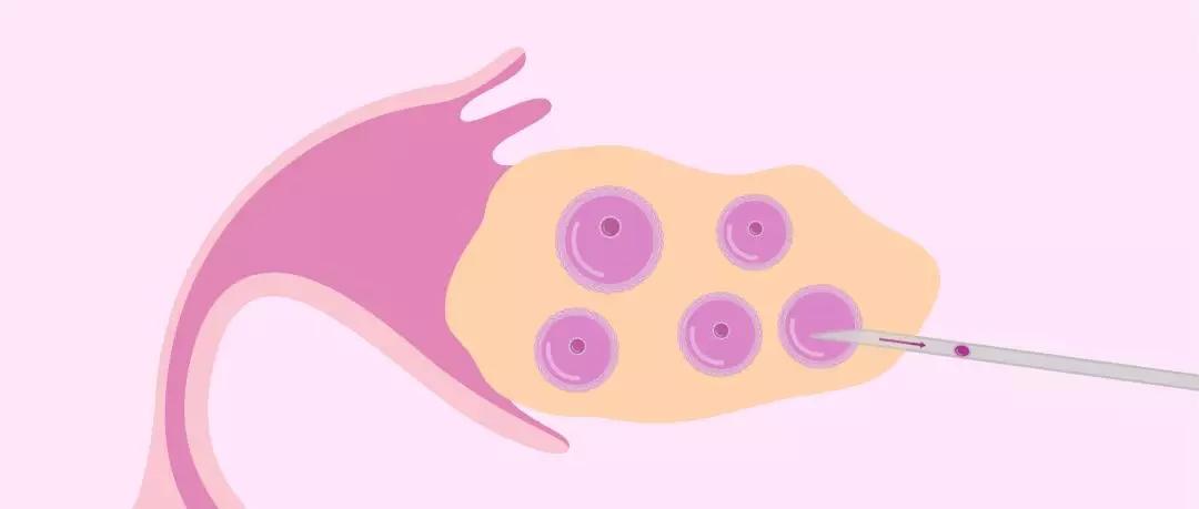 怎样才能得到高质量的卵子? 怎样才能得到高质量的卵子?