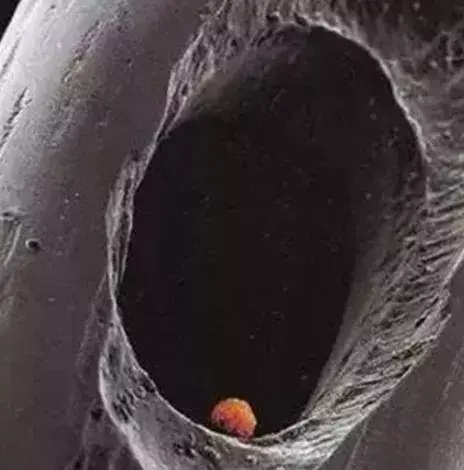 试管婴儿移植后胚胎会流出来吗? 试管婴儿移植后胚胎会流出来吗?