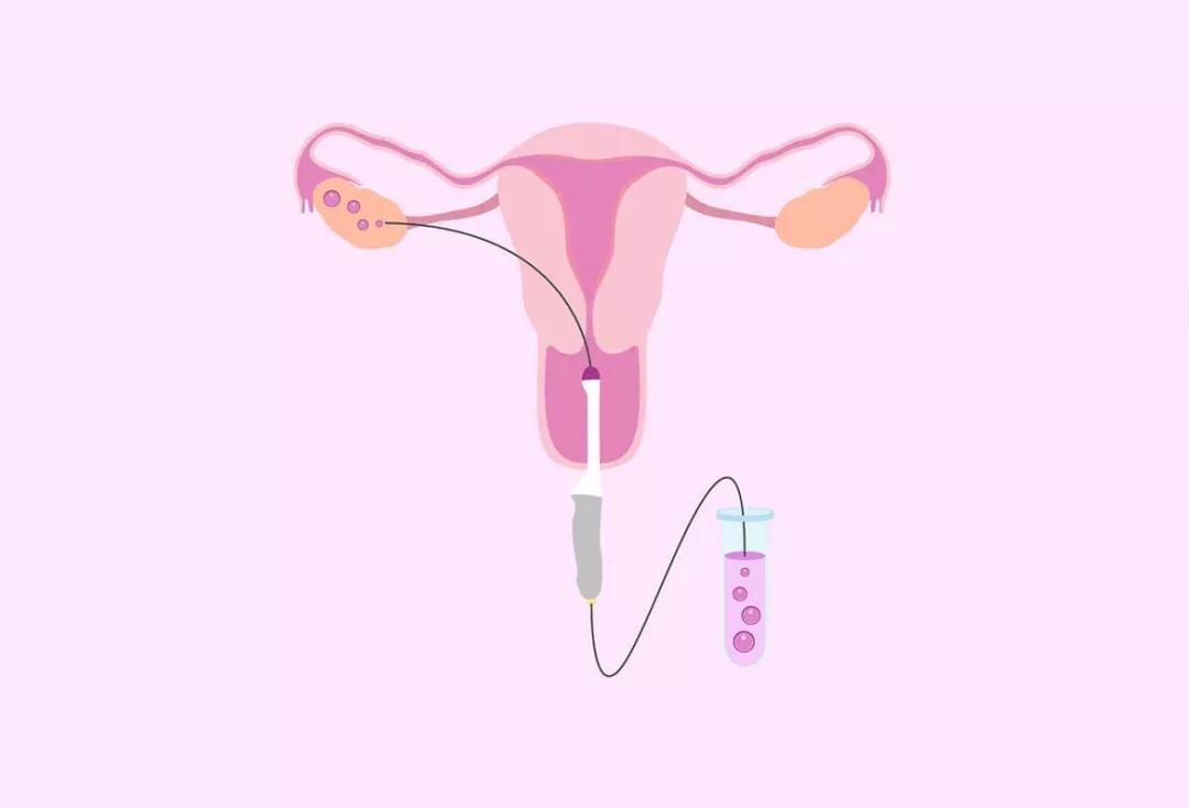 怎样才能得到高质量的卵子? 怎样才能得到高质量的卵子?