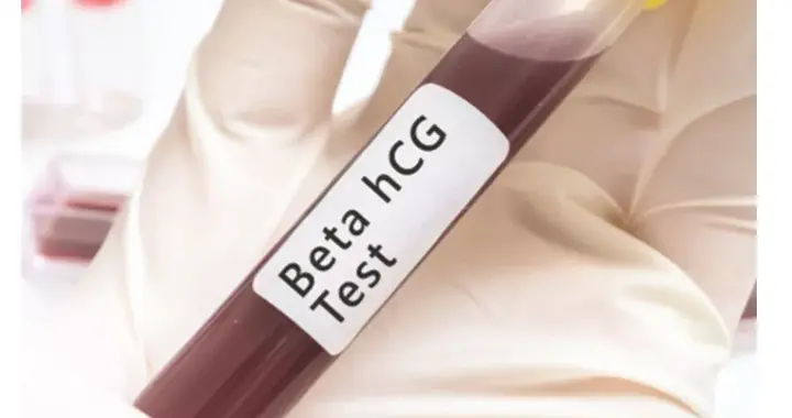 孕早期怎样监测血清HCG