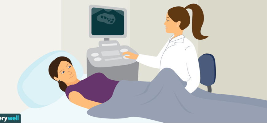 各有绝技——快评你们常用的4种促排卵方案