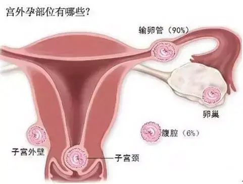 怀孕早期出血，宝宝会怎样？