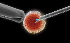 卵细胞浆内单精子注射的过程