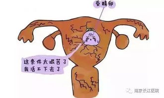 专家深度剖析胎停育,了解4个症状和6个病因,治疗其实很简单 专家深度剖析胎停育,了解4个症状和6个病因,治疗其实很简单